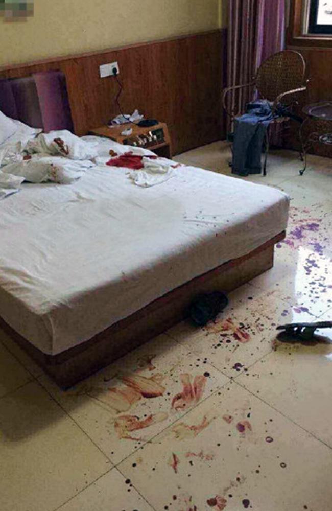 cena do crime... O homem fugiu quarto de hotel após o ataque horrível deixando um rastro de sangue. Imagem: CEN / Australscope.