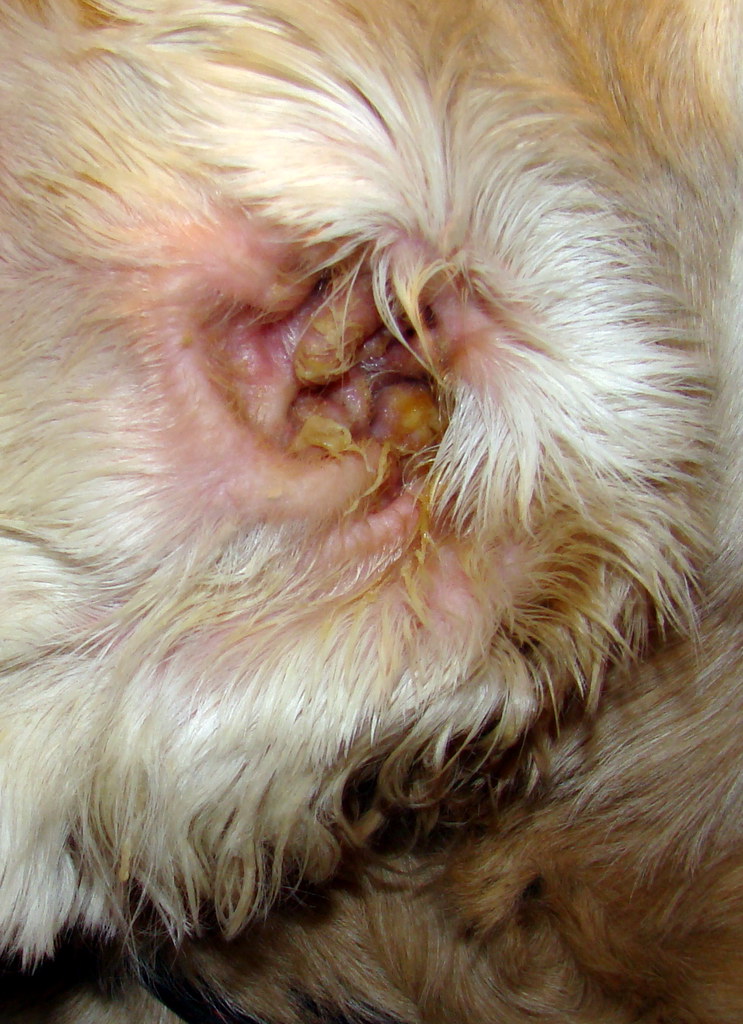 Tea Tree Oil Ear Infection IS A BACTERIAL INFECTION CONTAGIOUS