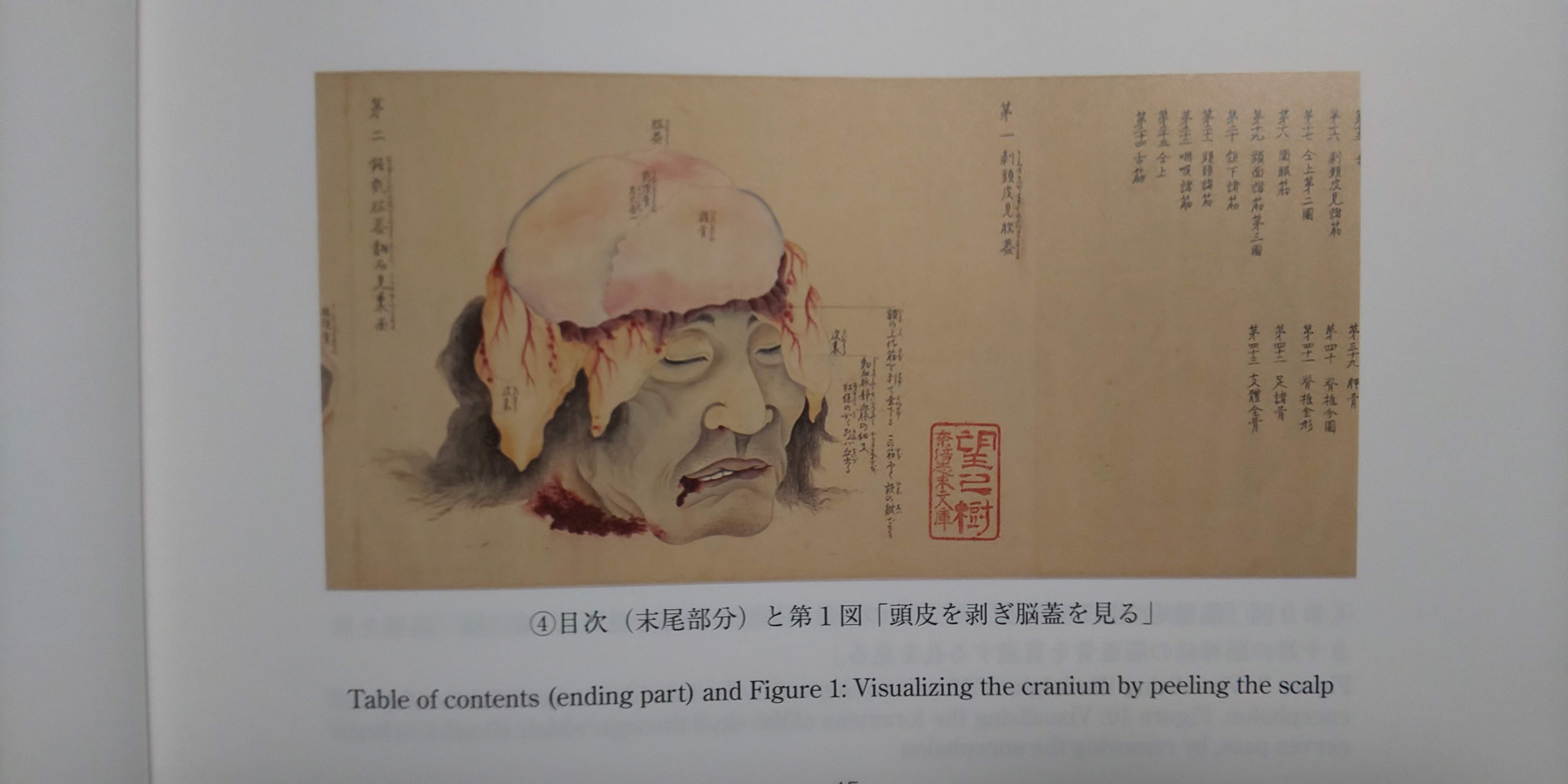 ��U���^�} (�����ڂ����񂵂�) ���̊� ���k��w�����}���ُ��� ����𔍂��]�W������