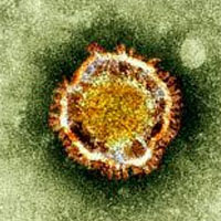 Middle East Respiratory Syndrome