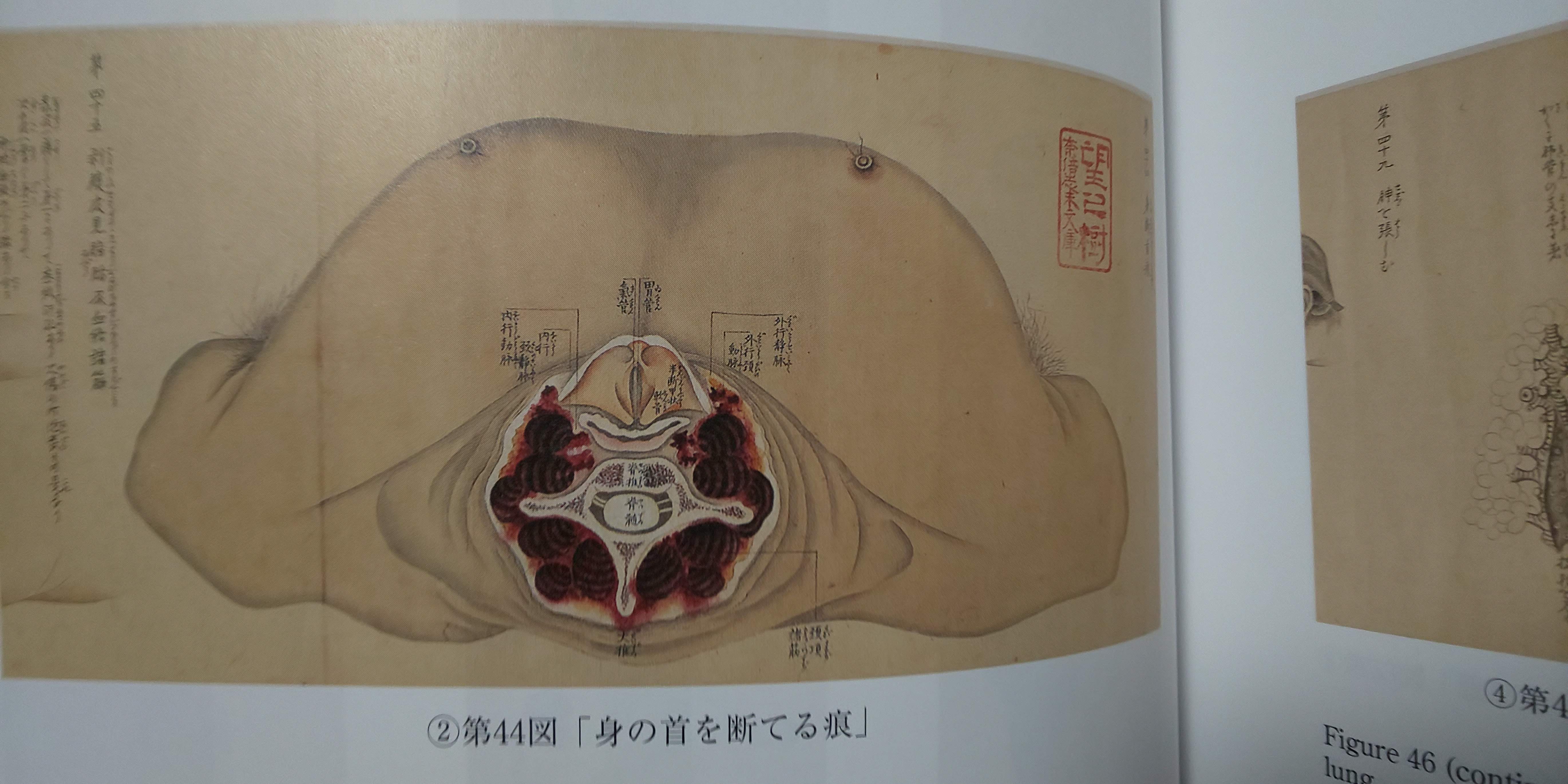 ��U���^�} (�����ڂ����񂵂�) ���̊� ���k��w�����}���ُ��� �a������ꂽ��̂̉�U