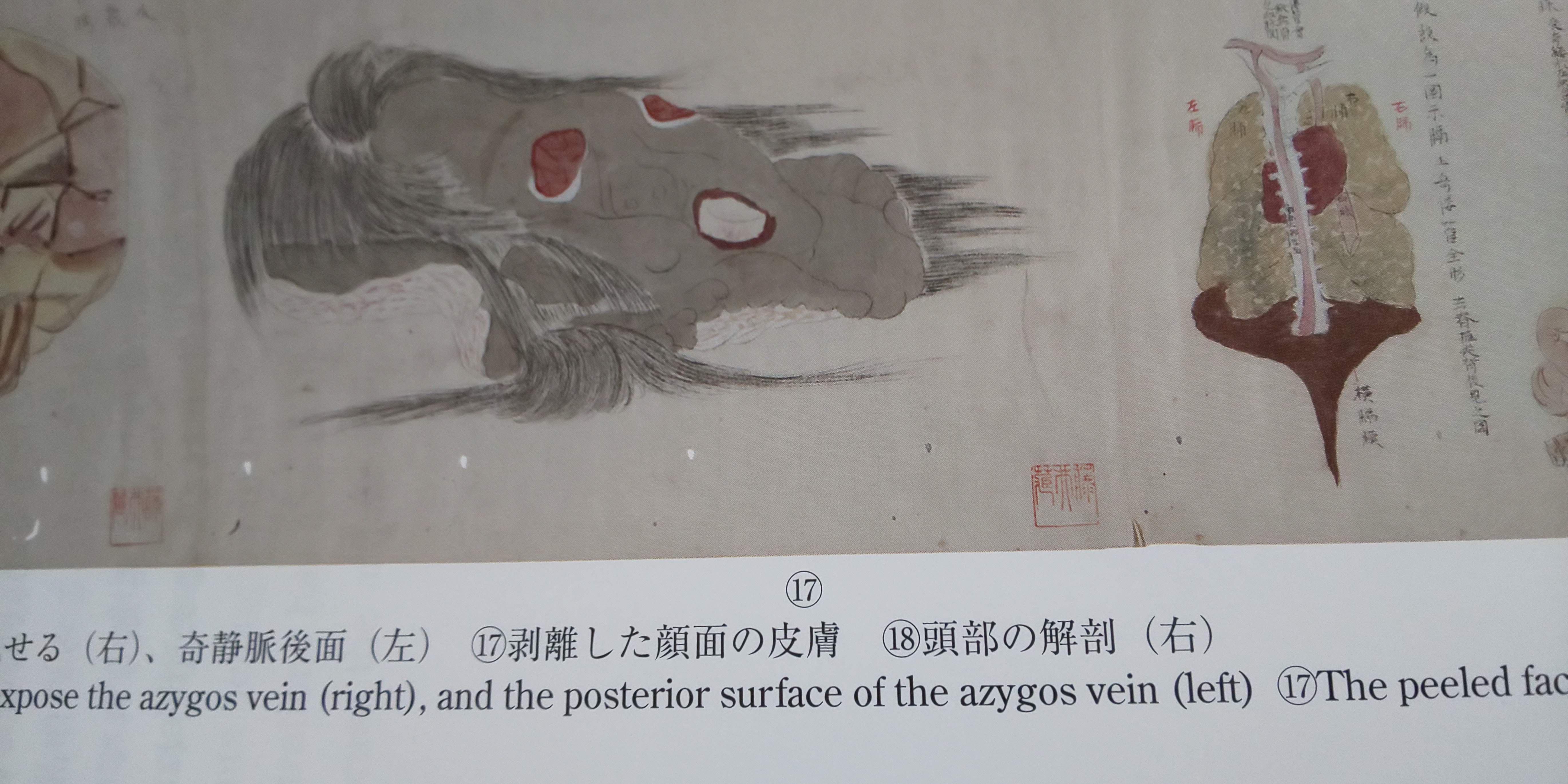 ���Y�r��U�V�}�^ (���傯���������ڂ��̂��낭) ���v���c�@�l���m���ɏ��� ����������ʂ̔畆