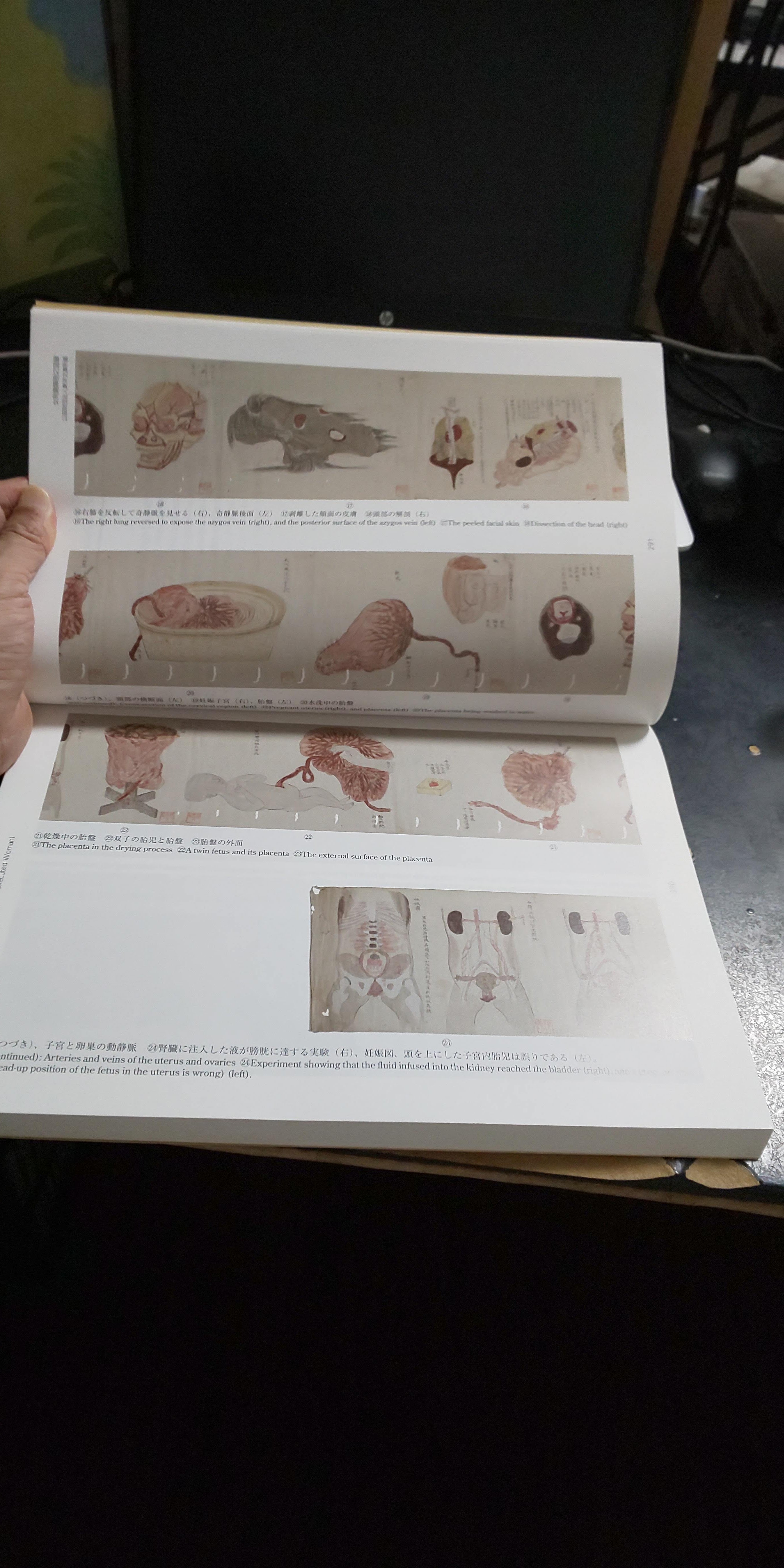 ���Y�r��U�V�}�^ (���傯���������ڂ��̂��낭) ���v���c�@�l���m���ɏ���