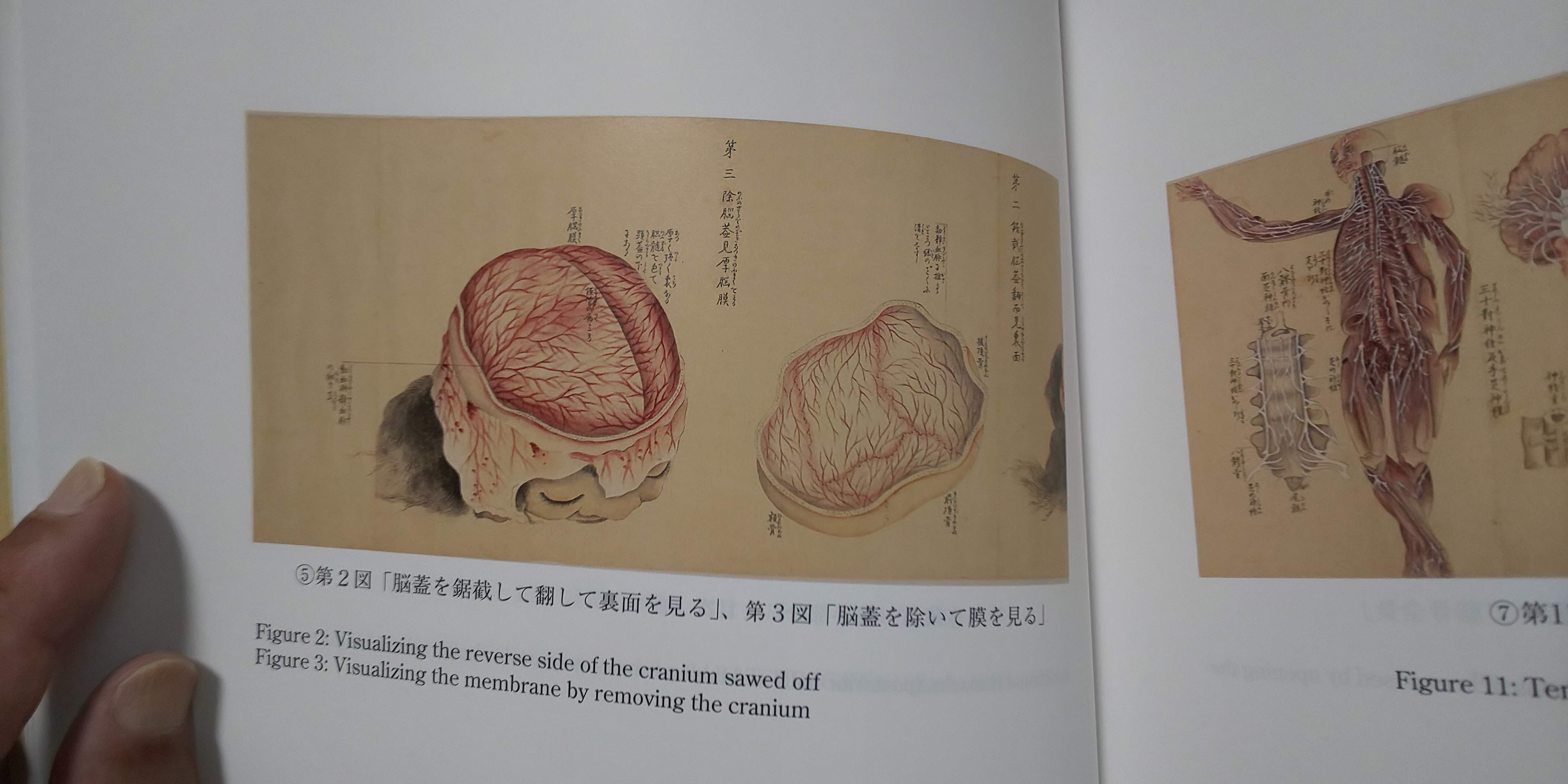 ��U���^�} (�����ڂ����񂵂�) ���̊� ���k��w�����}���ُ���