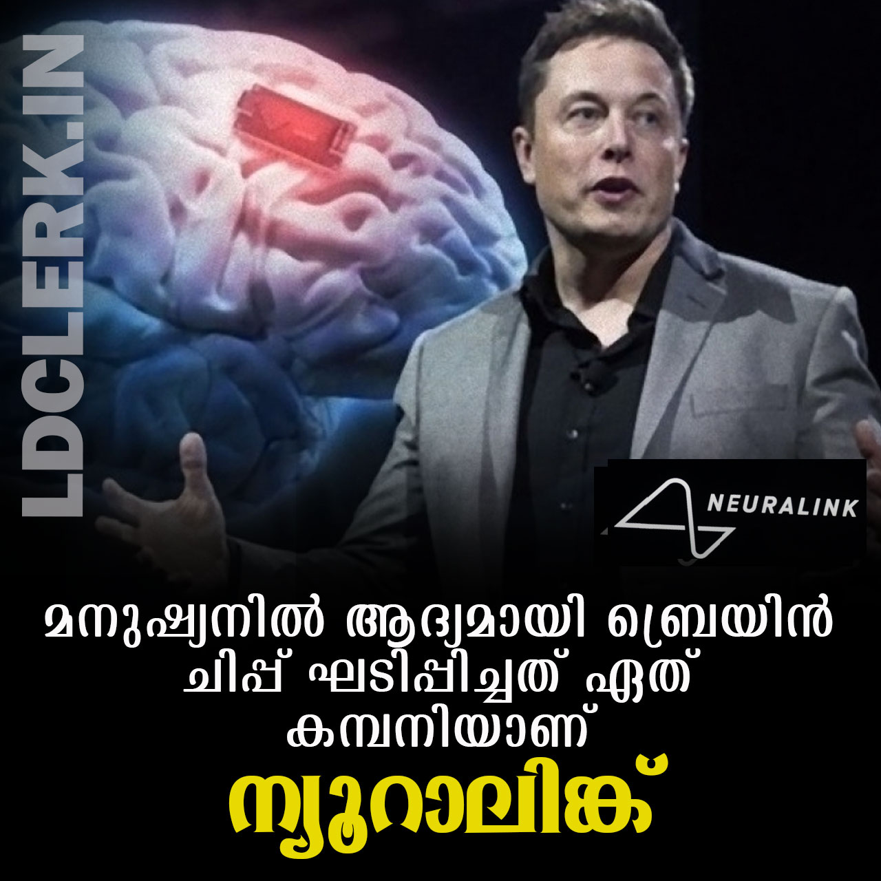 Neuralink